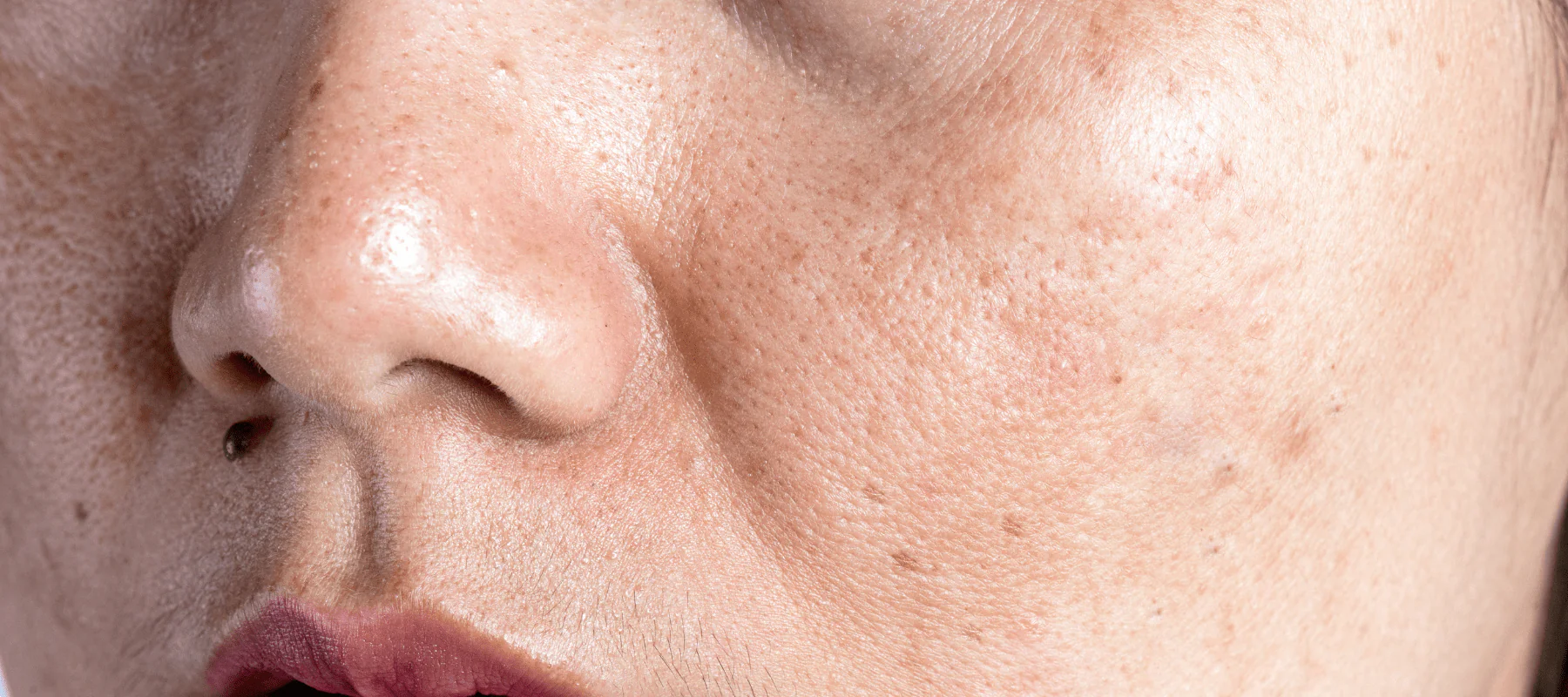 Highlighting_the_skin_discoloration_causes_and_treatments-min